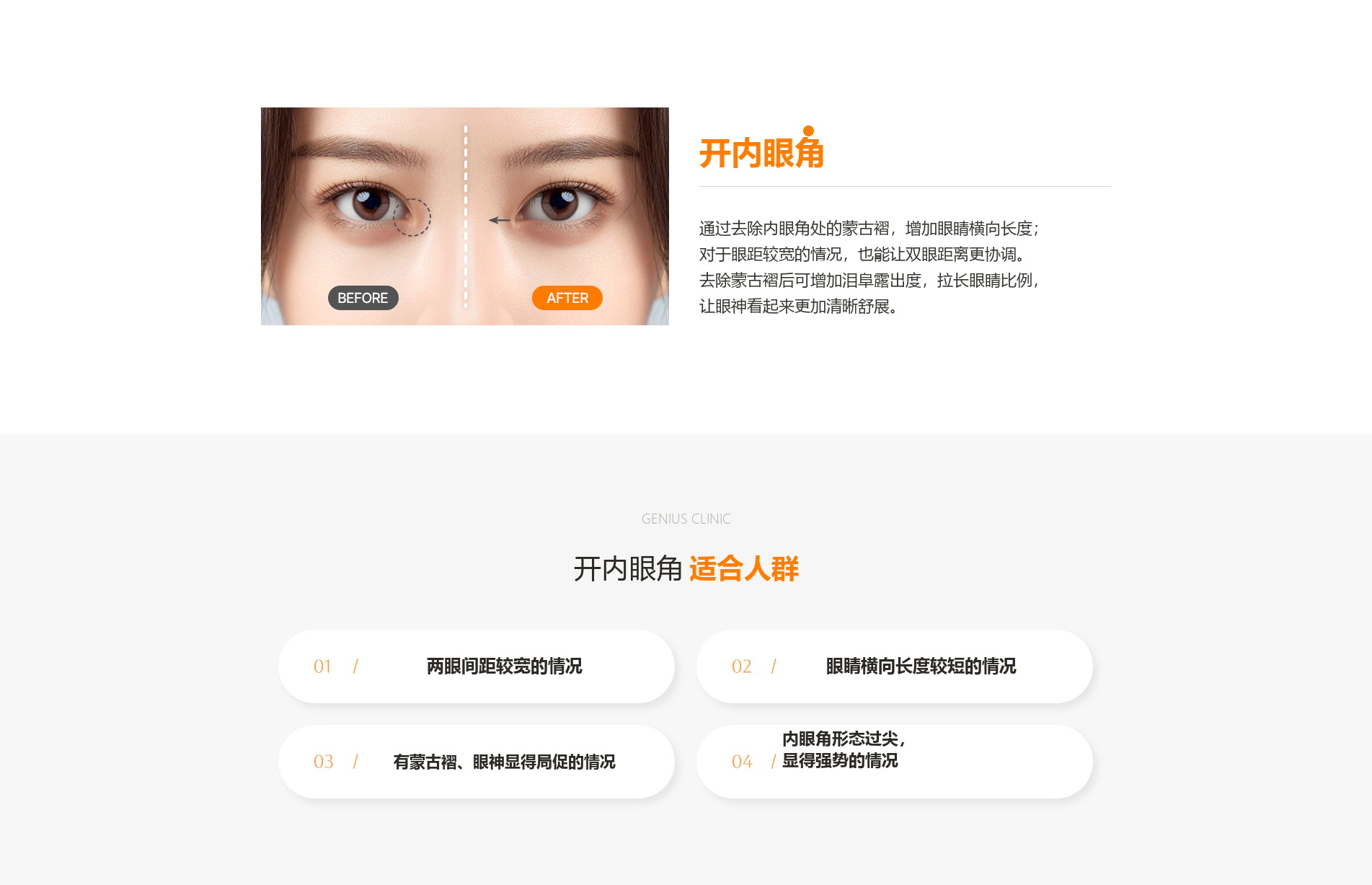 眼部整形 01