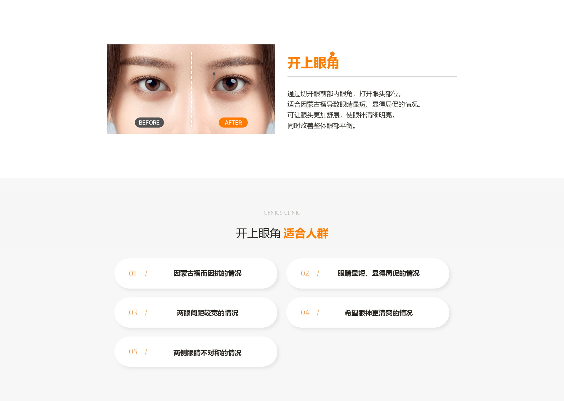 眼部整形 03