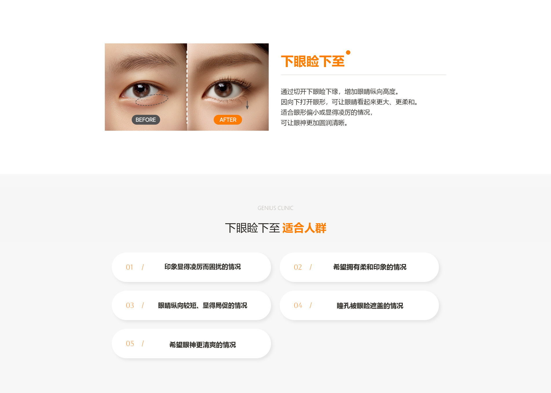 眼部整形 04